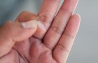 Myth: Gray hairs multiply when they’re plucked