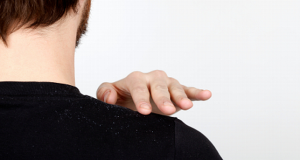 Is it dandruff or dry scalp?